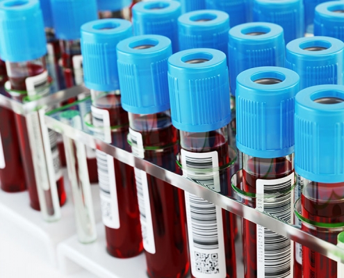 Blutproben stehen sortiert im Labor
