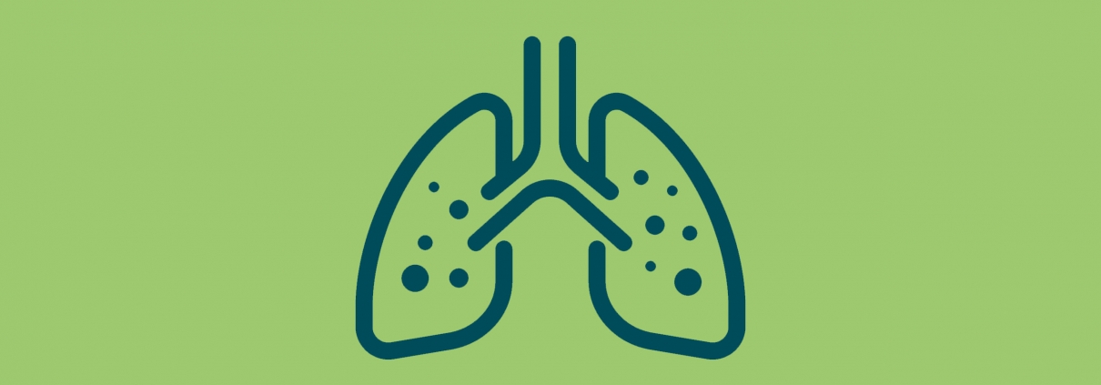 Grafische Darstellung von Lunge