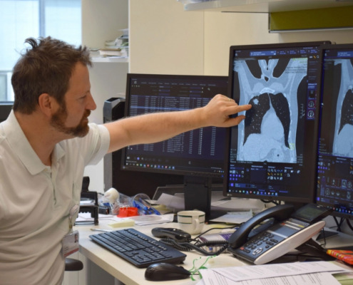Abteilung Innere_Medizin und Pneumologie Oberarzt Hochmair erklärt Lungentumor