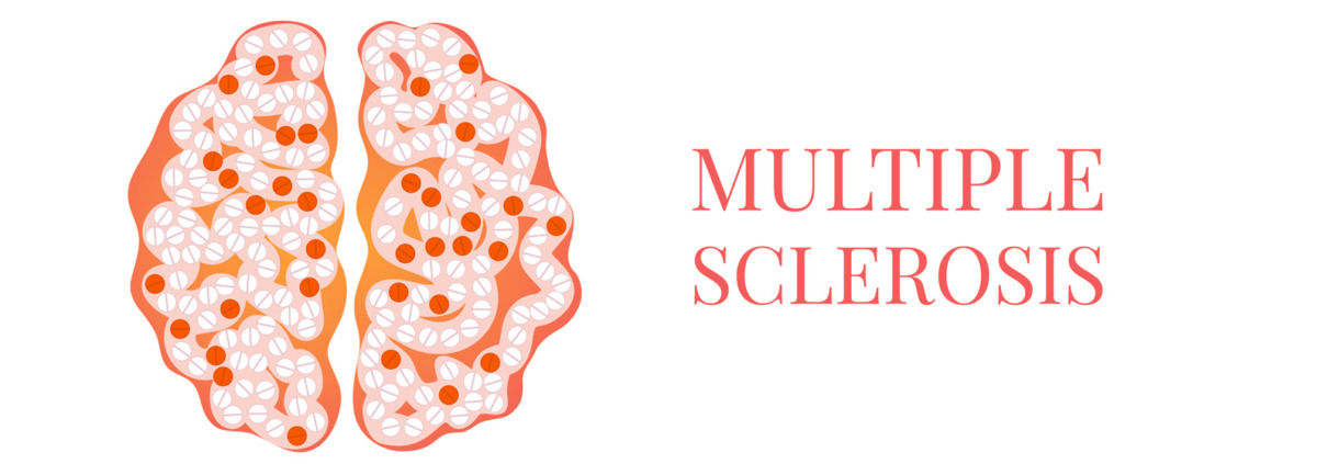 Grafik Multiple Skelrosis