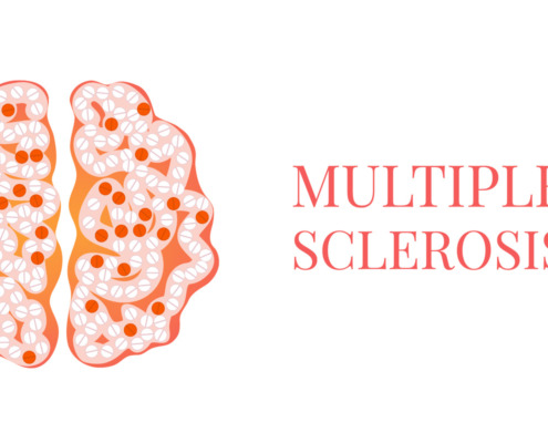 Grafik Multiple Skelrosis