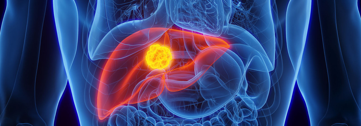 Hepatitis C Leber Illustration